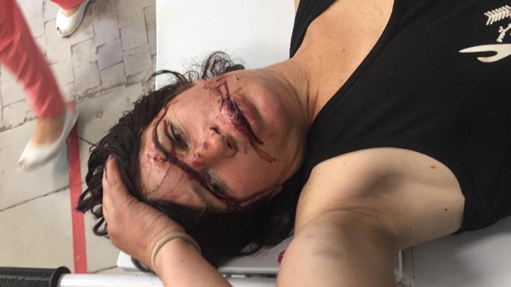 В Днепре коммунальщики задержали мужчину, который ногами избил женщину на глазах у прохожих. Фото: Нацполиция